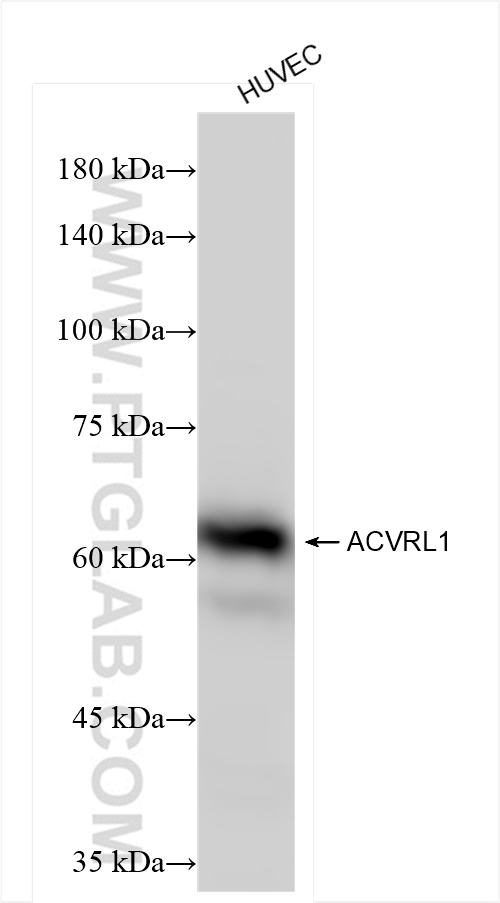 ACVRL1