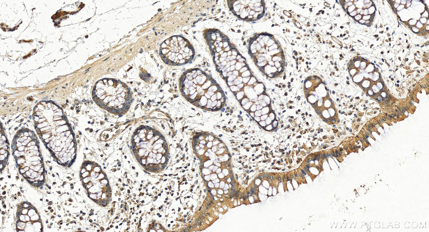 Immunohistochemistry (IHC) staining of human colon tissue using ACY3 Polyclonal antibody (16786-1-AP)