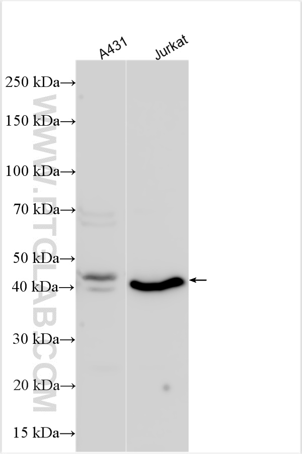 Western Blot (WB) analysis of various lysates using ADA Polyclonal antibody (13328-1-AP)