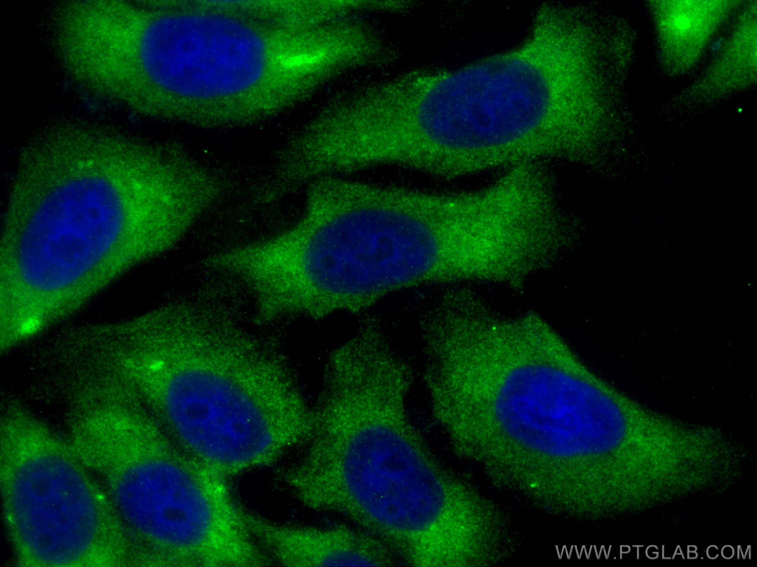 Immunofluorescence (IF) / fluorescent staining of HepG2 cells using ADAM12 Polyclonal antibody (14139-1-AP)