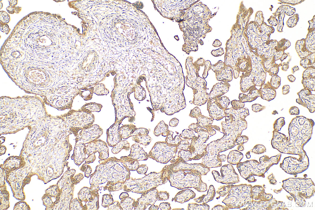 Immunohistochemistry (IHC) staining of human placenta tissue using ADAM12 Polyclonal antibody (14139-1-AP)