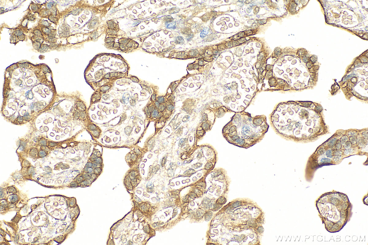 Immunohistochemistry (IHC) staining of human placenta tissue using ADAM12 Polyclonal antibody (14139-1-AP)