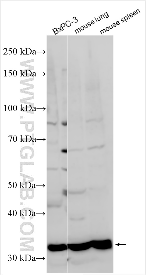 Western Blot (WB) analysis of various lysates using ADAM28 Polyclonal antibody (22234-1-AP)