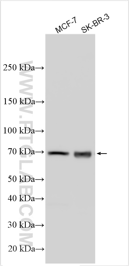 Western Blot (WB) analysis of various lysates using ADAM33 Polyclonal antibody (22860-1-AP)