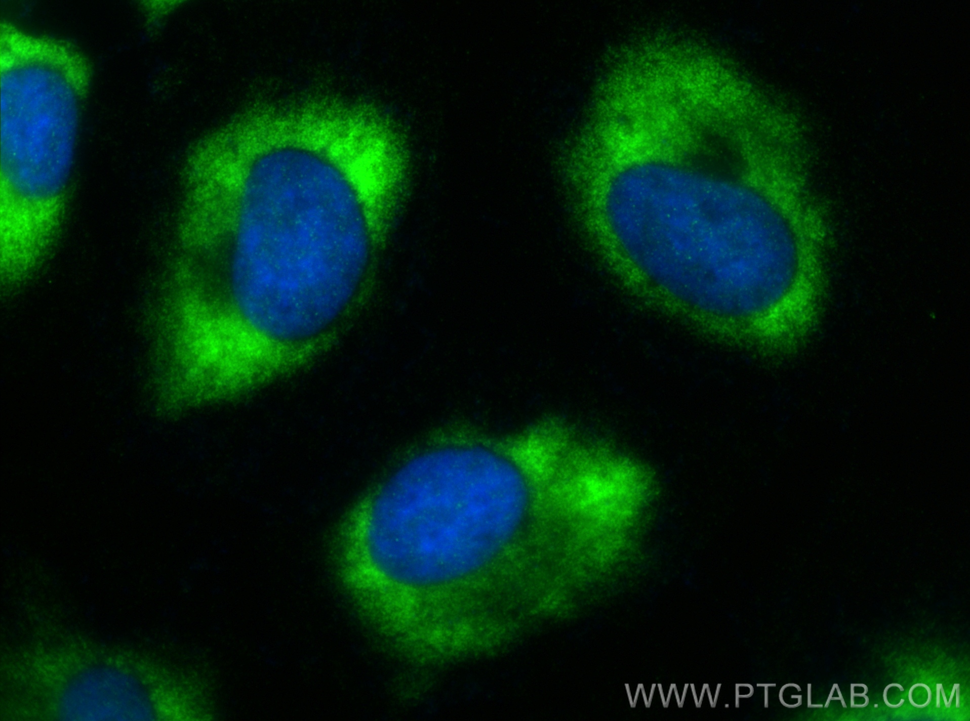 Immunofluorescence (IF) / fluorescent staining of HeLa cells using ADAM5 Polyclonal antibody (22147-1-AP)