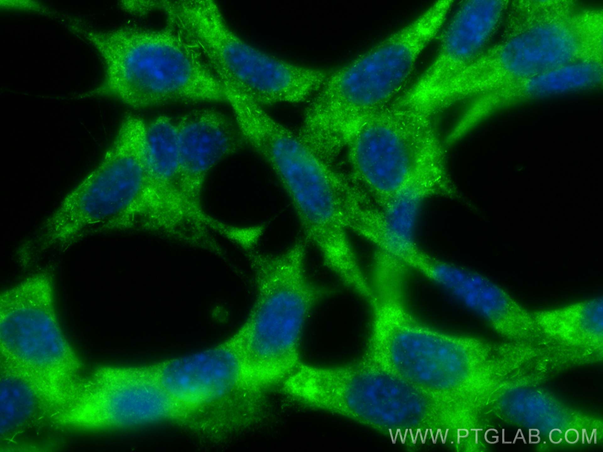 Immunofluorescence (IF) / fluorescent staining of NIH/3T3 cells using ADAMTS12 Polyclonal antibody (24934-1-AP)