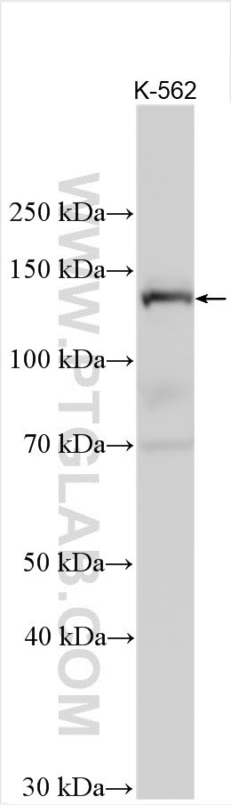 Western Blot (WB) analysis of various lysates using ADAMTS14 Polyclonal antibody (31075-1-AP)