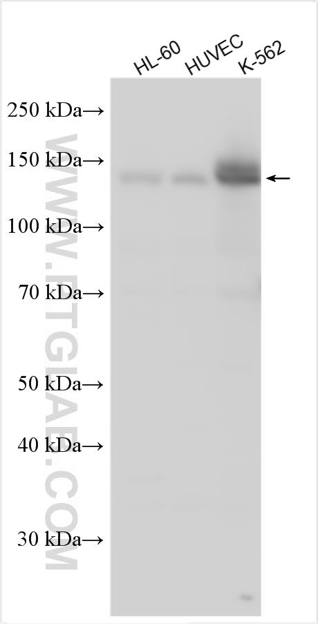 Western Blot (WB) analysis of various lysates using ADAMTS14 Polyclonal antibody (31075-1-AP)