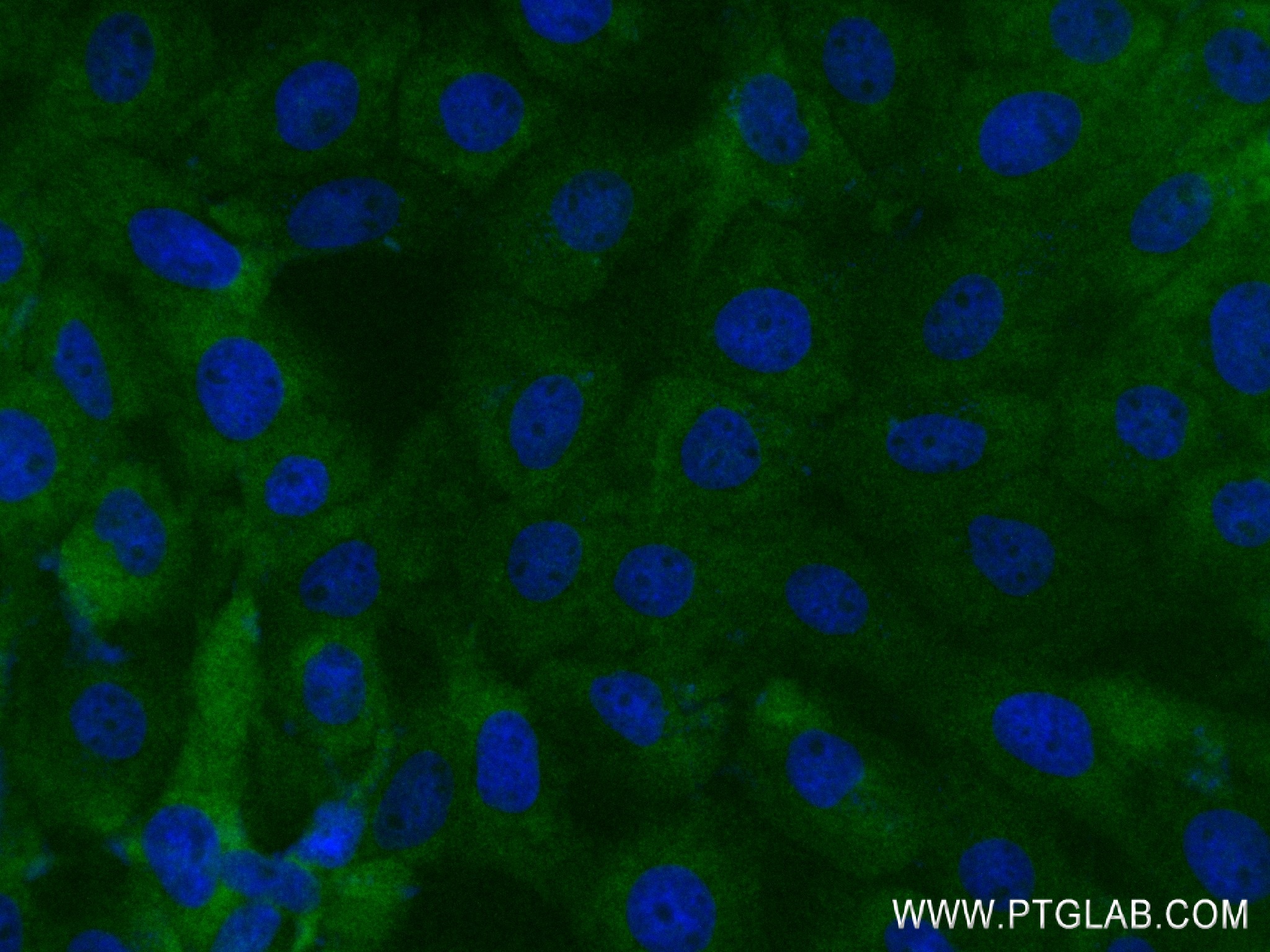 Immunofluorescence (IF) / fluorescent staining of A431 cells using ADAMTS2 Recombinant antibody (84476-6-RR)