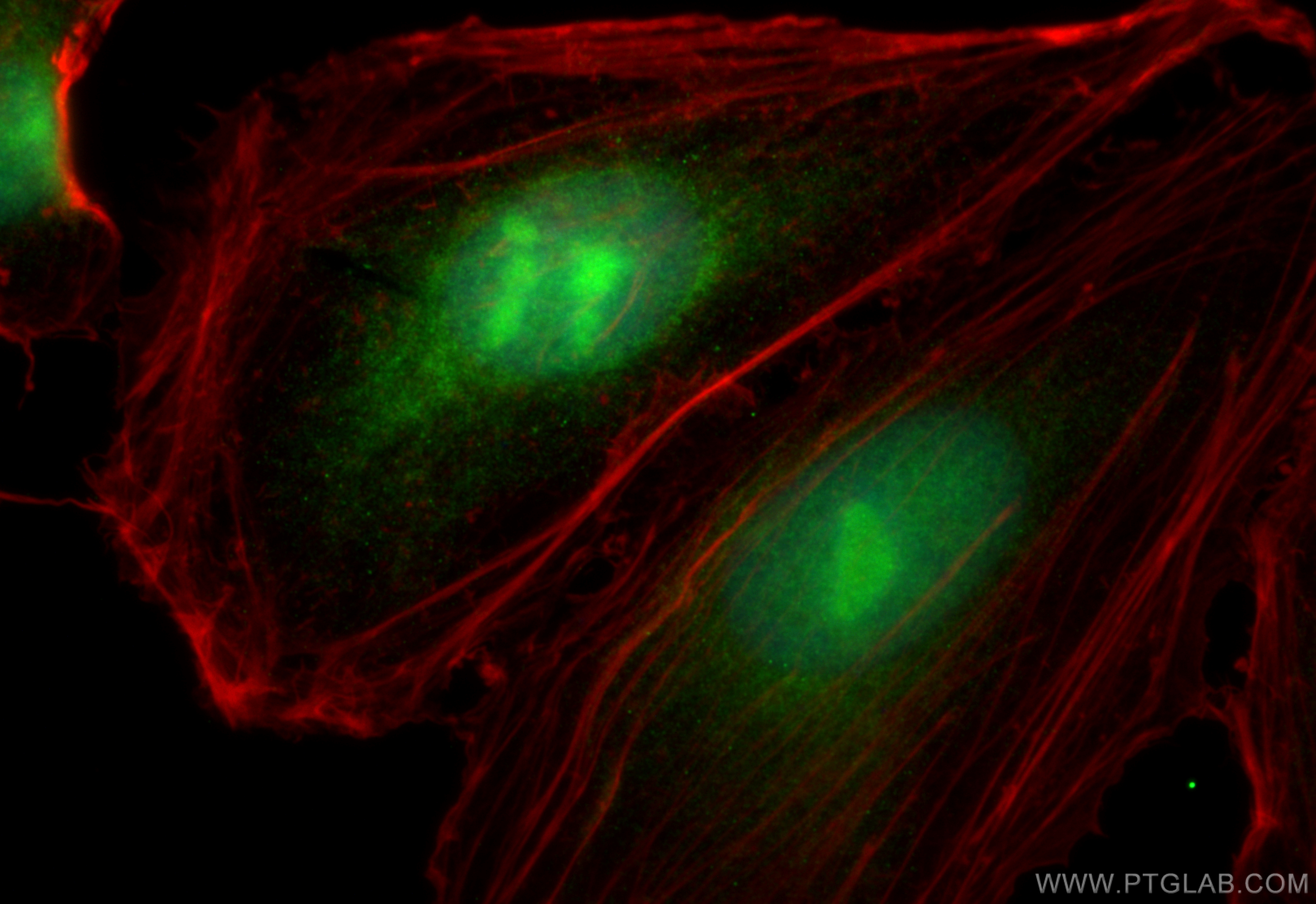 Immunofluorescence (IF) / fluorescent staining of HeLa cells using ADAR1 Polyclonal antibody (14330-1-AP)