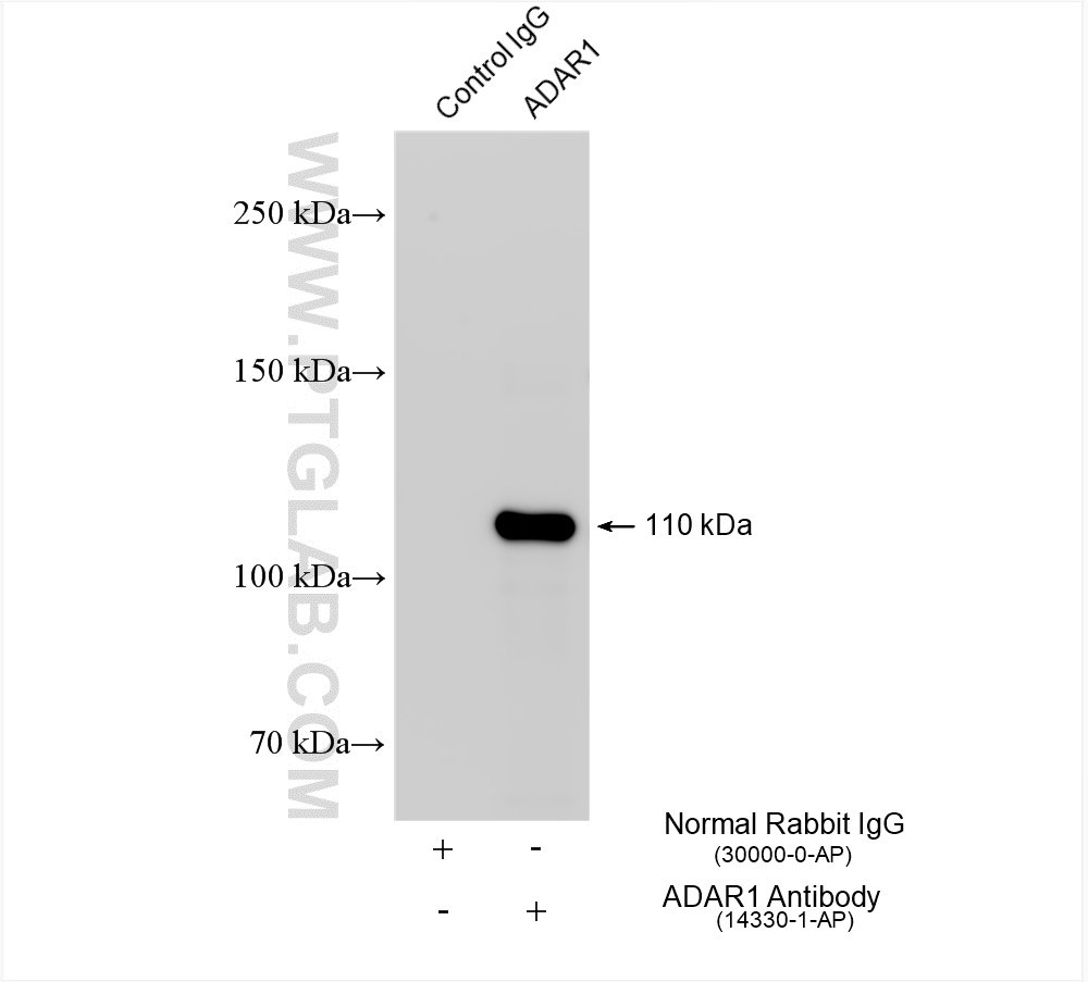 Immunoprecipitation (IP) experiment of HepG2 cells using ADAR1 Polyclonal antibody (14330-1-AP)