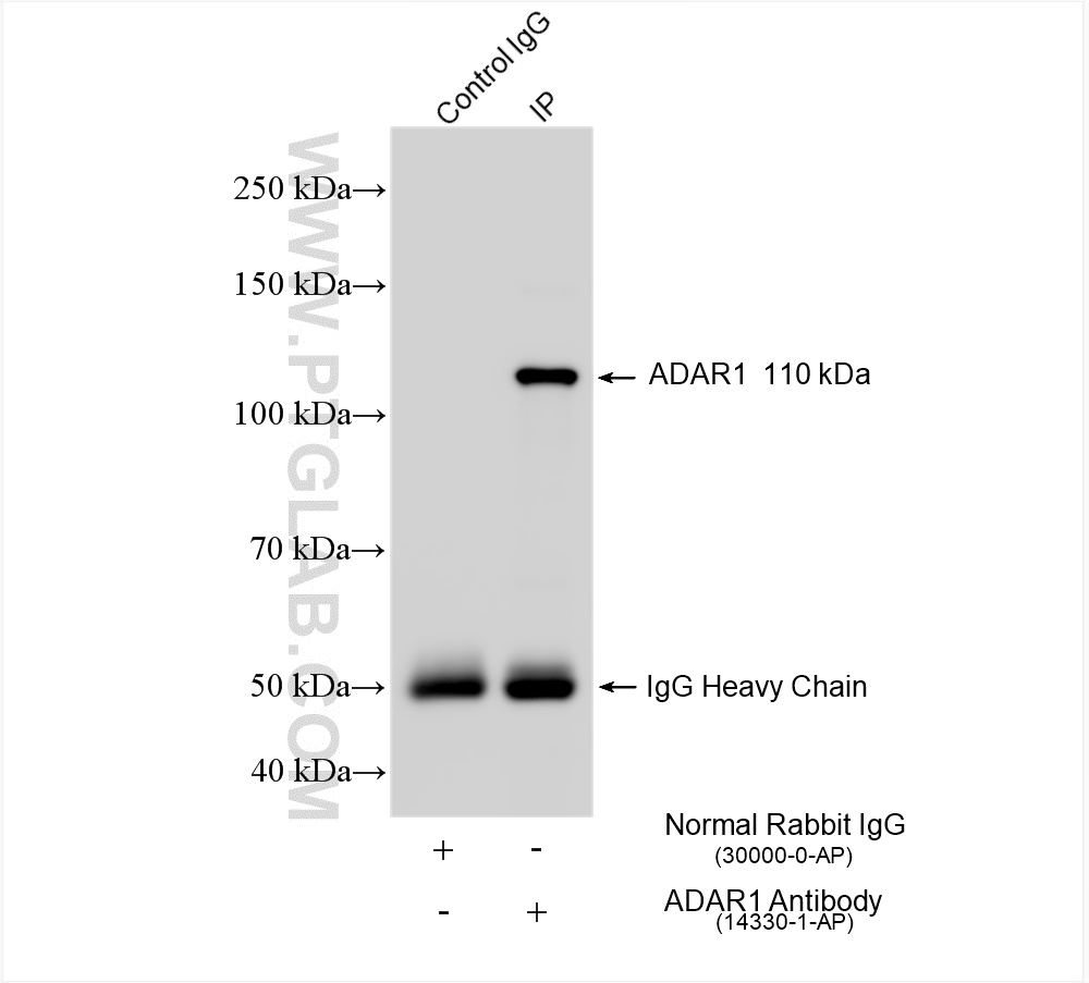 Immunoprecipitation (IP) experiment of HepG2 cells using ADAR1 Polyclonal antibody (14330-1-AP)