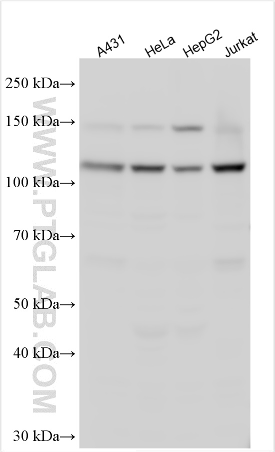 Western Blot (WB) analysis of various lysates using ADAR1 Polyclonal antibody (14330-1-AP)