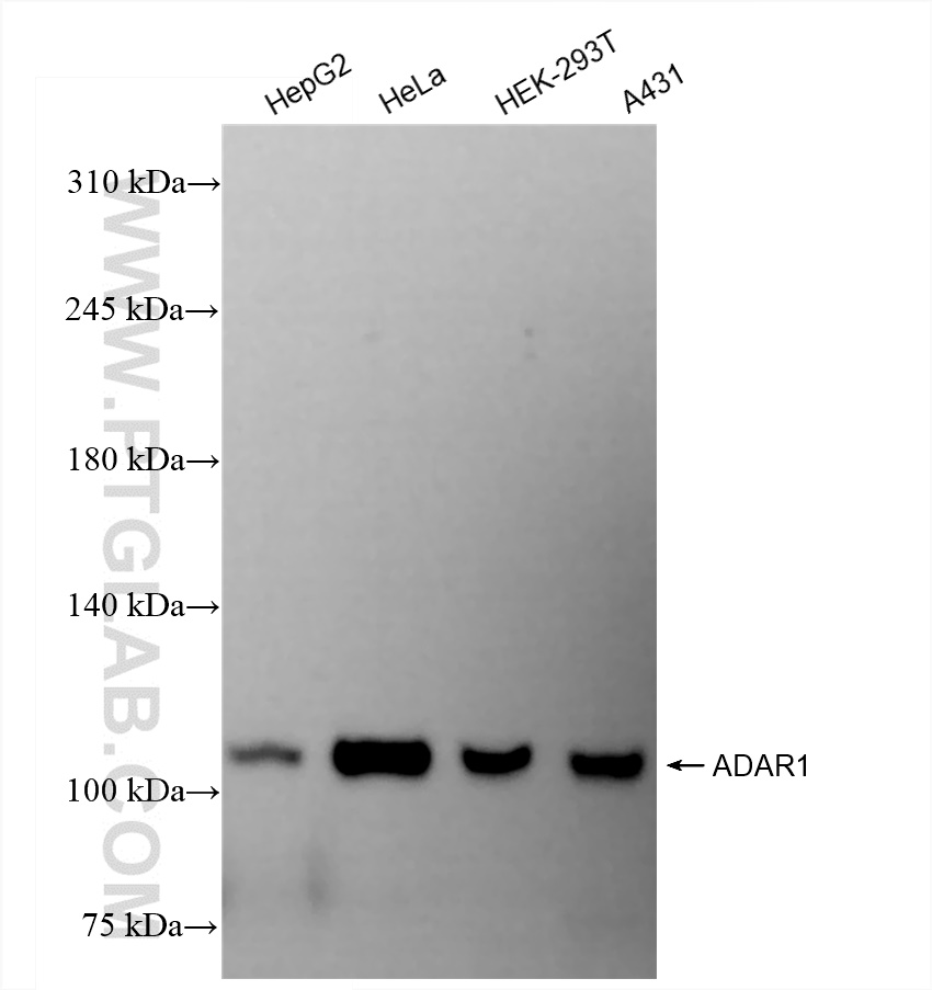 Western Blot (WB) analysis of various lysates using ADAR1 Recombinant antibody (85009-1-RR)