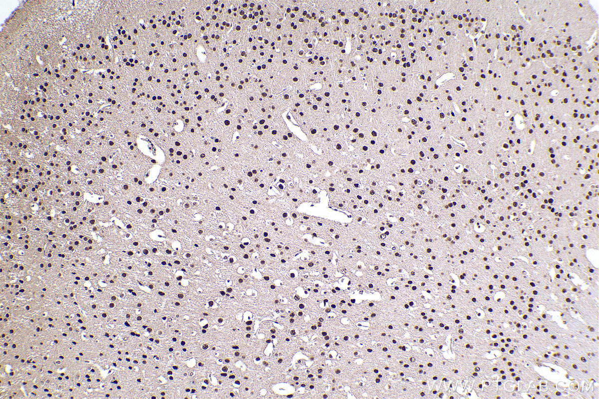 Immunohistochemistry (IHC) staining of mouse brain tissue using ADARB1 Polyclonal antibody (22248-1-AP)