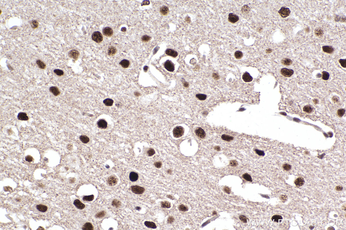 Immunohistochemistry (IHC) staining of mouse brain tissue using ADARB1 Polyclonal antibody (22248-1-AP)