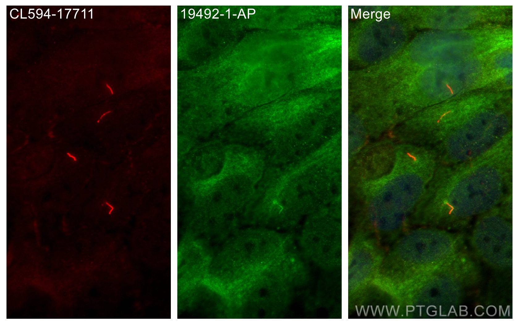 Immunofluorescence (IF) / fluorescent staining of hTERT-RPE1 cells using ADCY3 Polyclonal antibody (19492-1-AP)