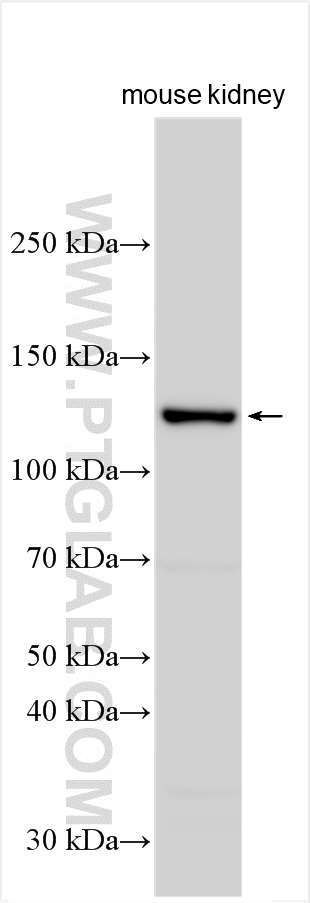 Western Blot (WB) analysis of various lysates using ADCY3 Polyclonal antibody (19492-1-AP)