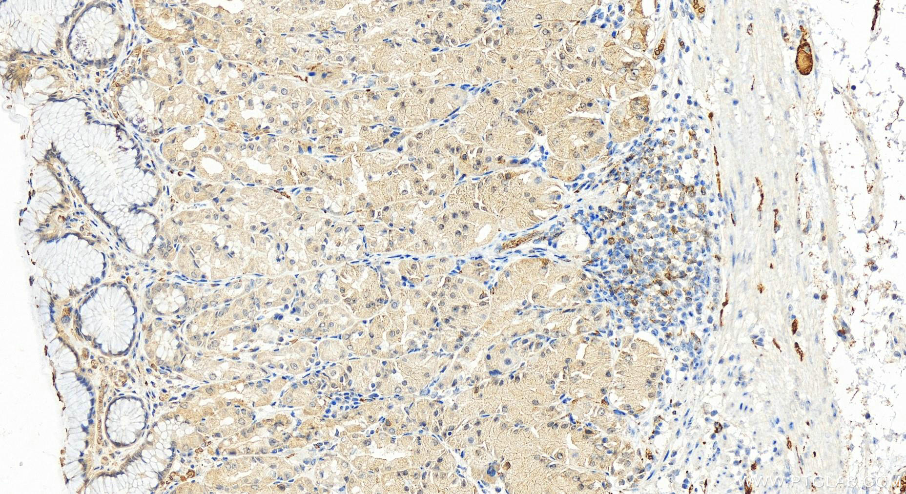 Immunohistochemistry (IHC) staining of human stomach tissue using Beta Adducin Polyclonal antibody (14640-1-AP)