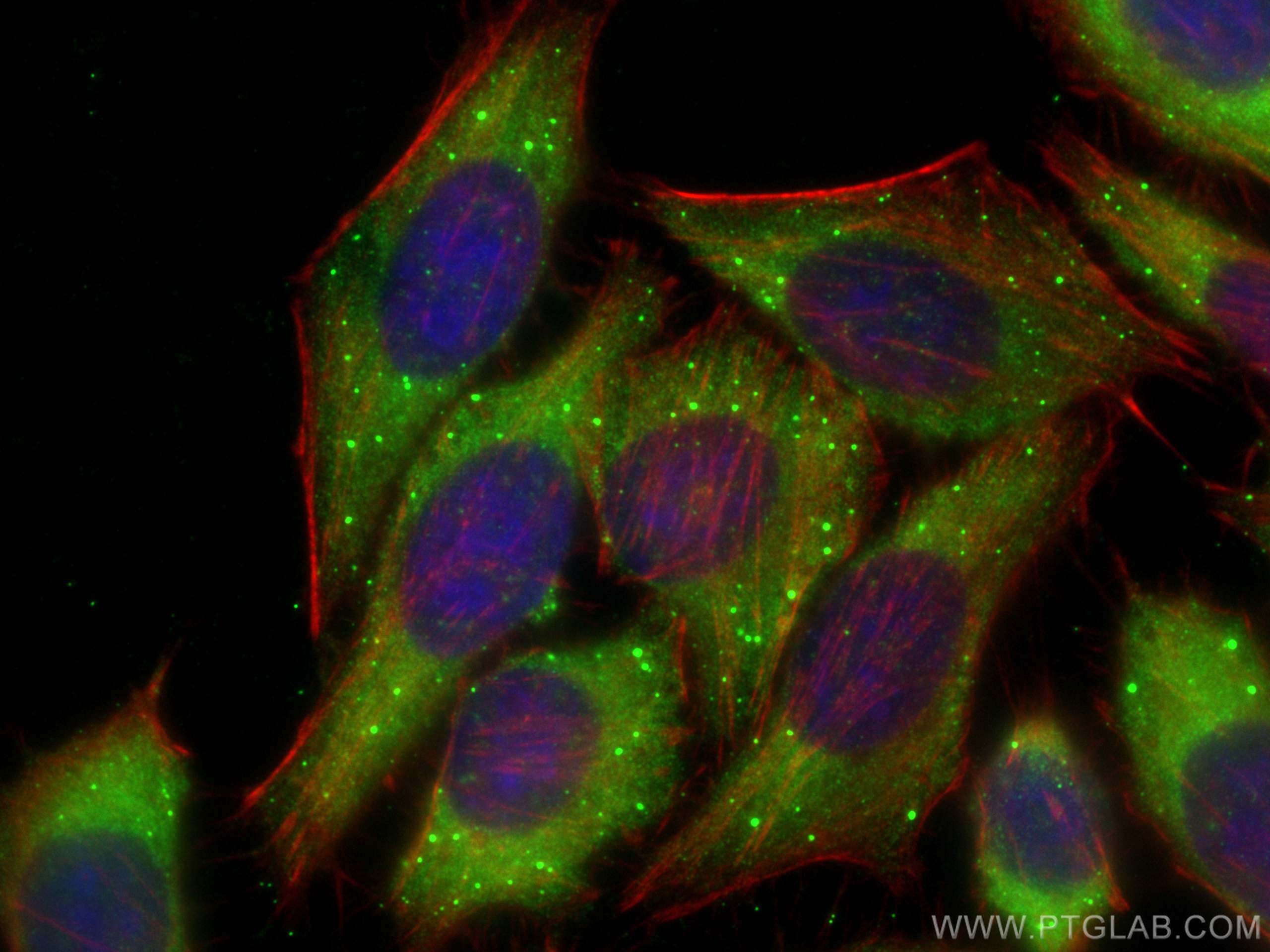 Immunofluorescence (IF) / fluorescent staining of HepG2 cells using ADH1C Polyclonal antibody (18897-1-AP)