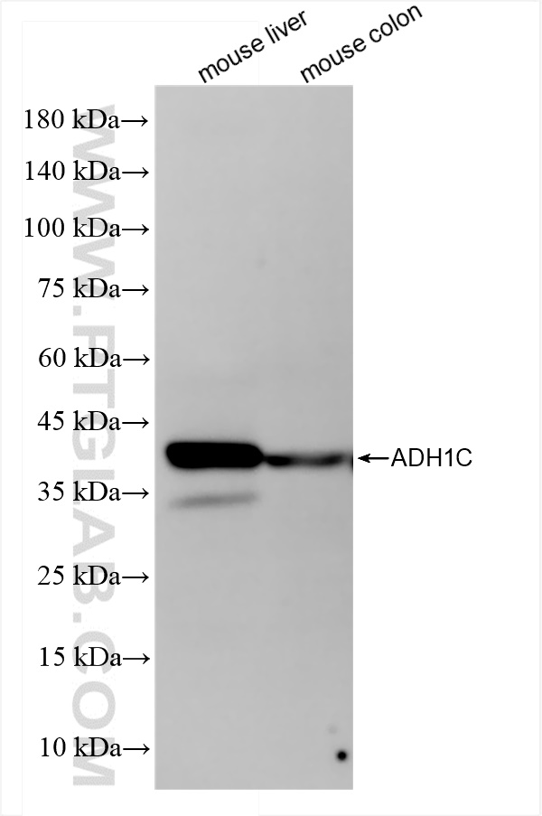 Western Blot (WB) analysis of various lysates using ADH1C Recombinant antibody (84546-1-RR)