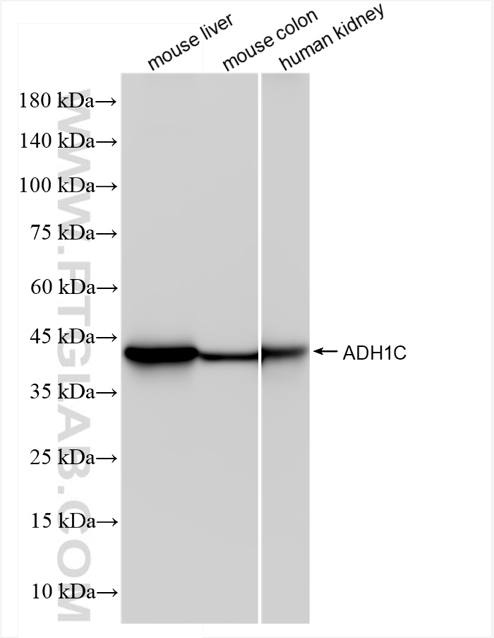 Western Blot (WB) analysis of various lysates using ADH1C Recombinant antibody (84546-2-RR)