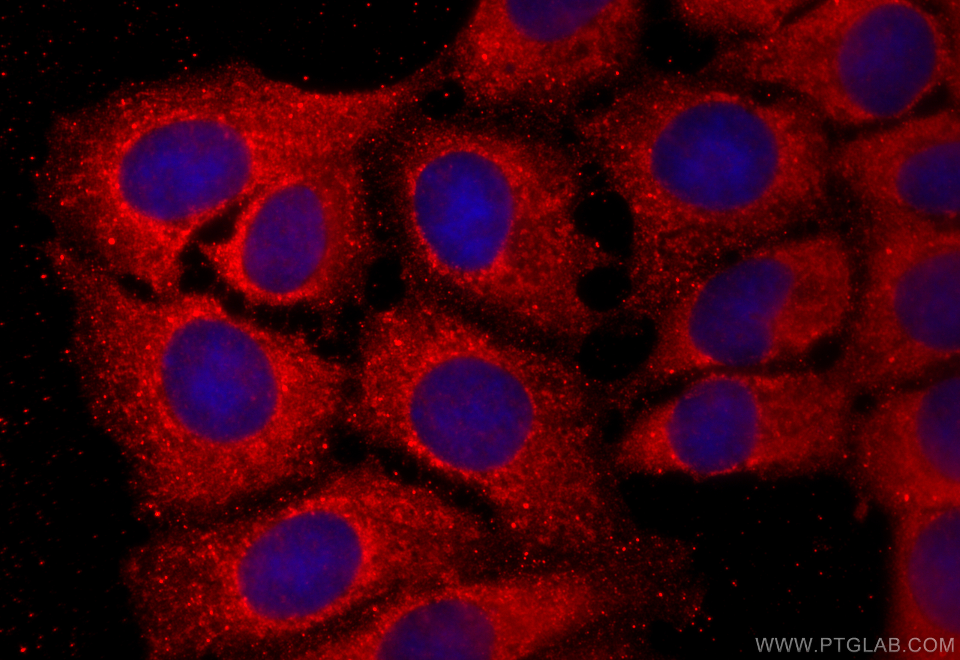 Immunofluorescence (IF) / fluorescent staining of MCF-7 cells using ADH6 Polyclonal antibody (13288-2-AP)