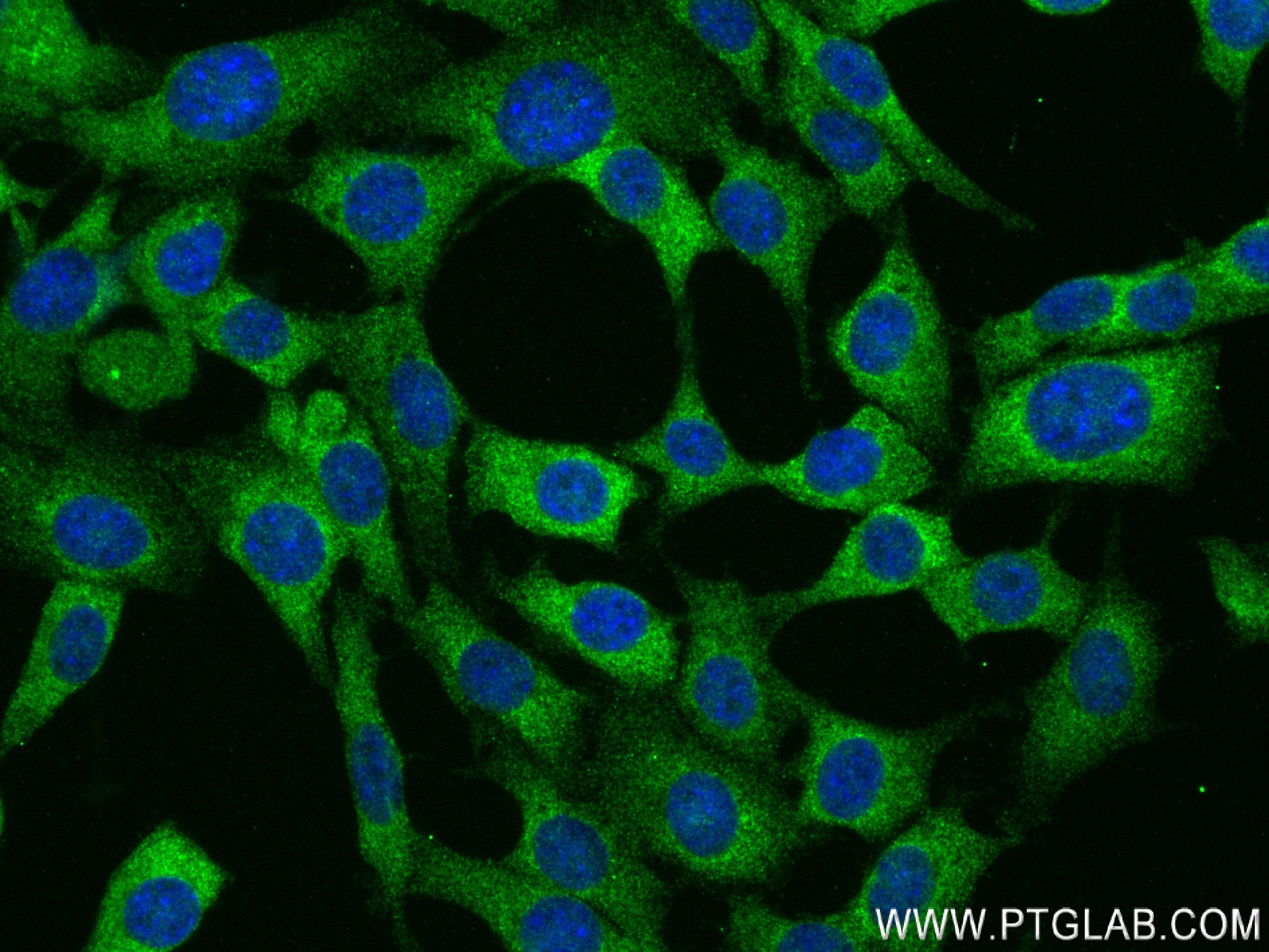 Immunofluorescence (IF) / fluorescent staining of 3T3-L1 cells using Adiponectin Recombinant antibody (83961-3-RR)