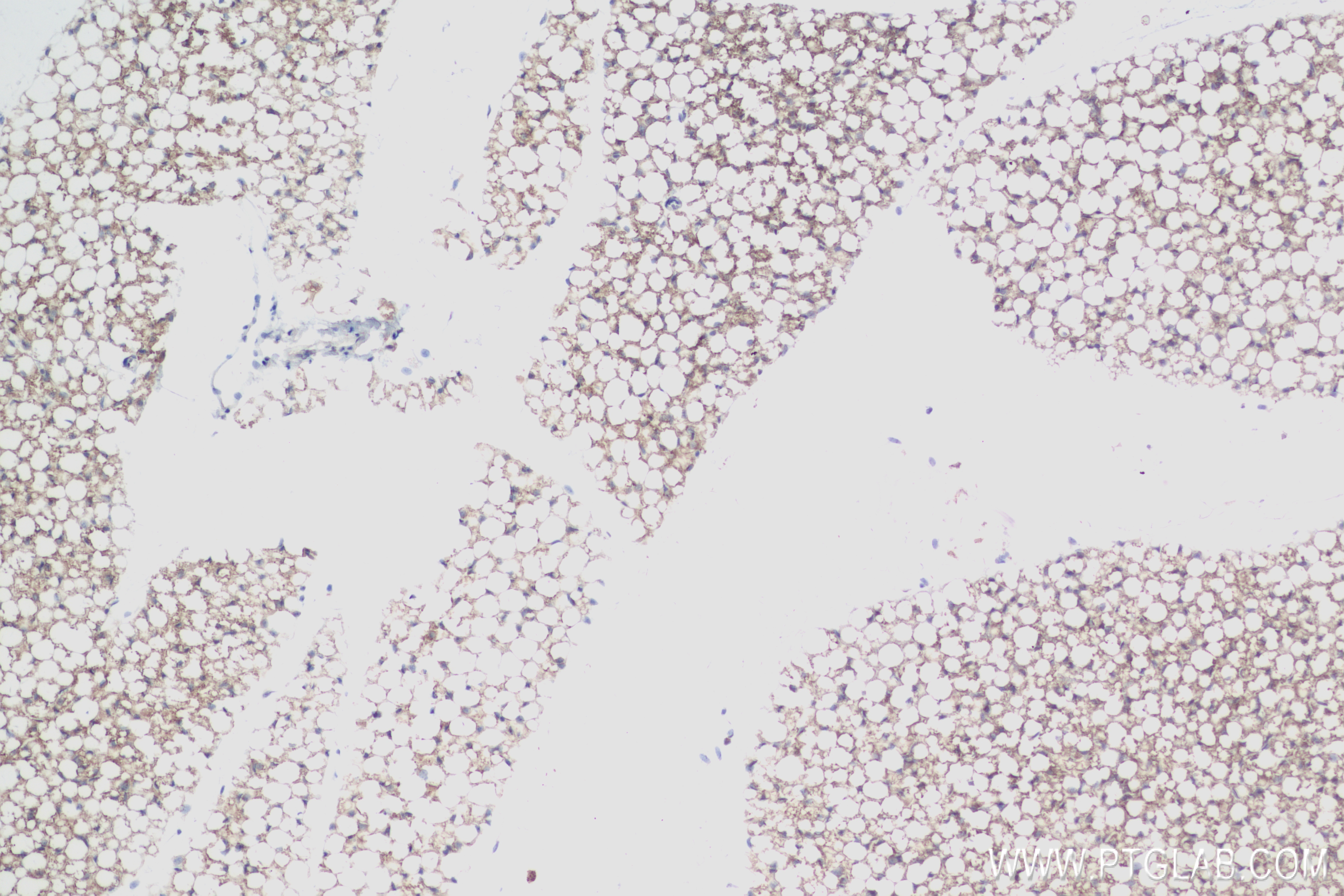 Immunohistochemistry (IHC) staining of mouse brown adipose tissue using Adiponectin Recombinant antibody (83961-3-RR)