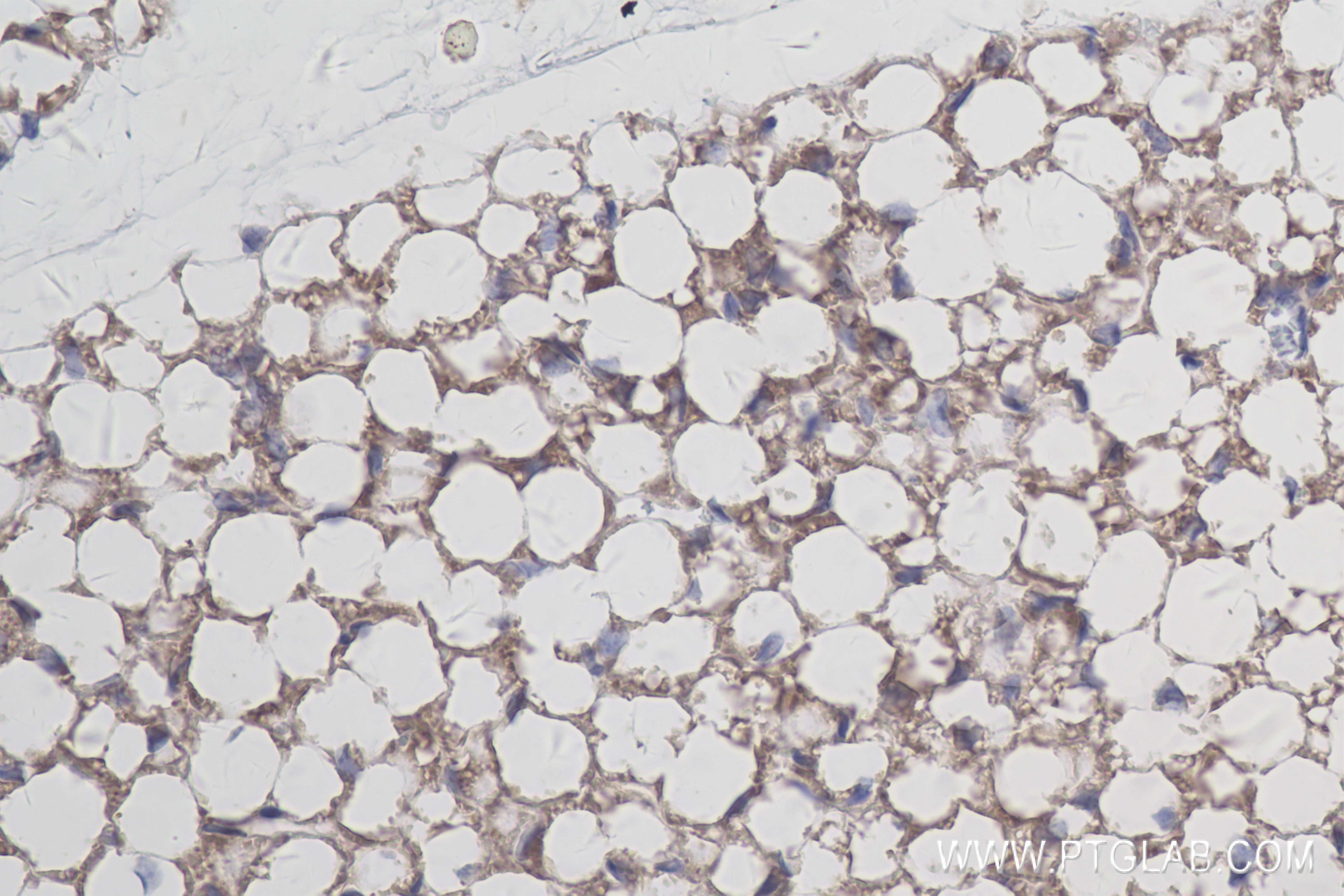 Immunohistochemistry (IHC) staining of mouse brown adipose tissue using Adiponectin Recombinant antibody (83961-3-RR)