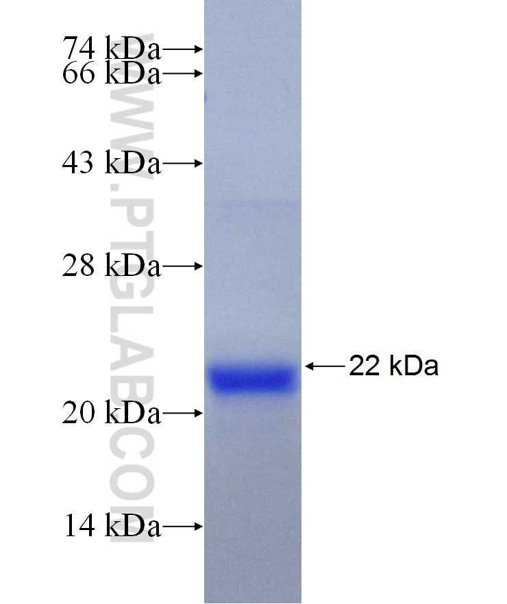 ADIPOR2 fusion protein Ag29883 SDS-PAGE