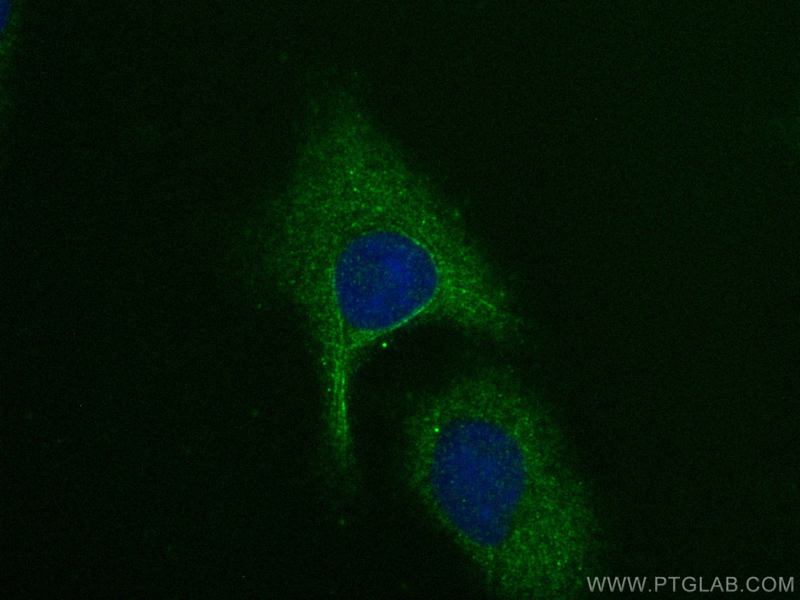 Immunofluorescence (IF) / fluorescent staining of A549 cells using Adrenomedullin Polyclonal antibody (10778-1-AP)