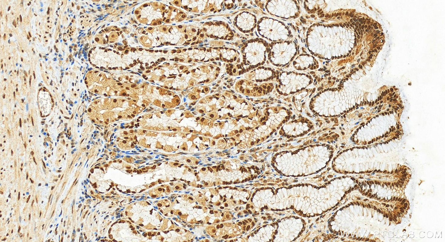 Immunohistochemistry (IHC) staining of human stomach tissue using ADNP Polyclonal antibody (17987-1-AP)