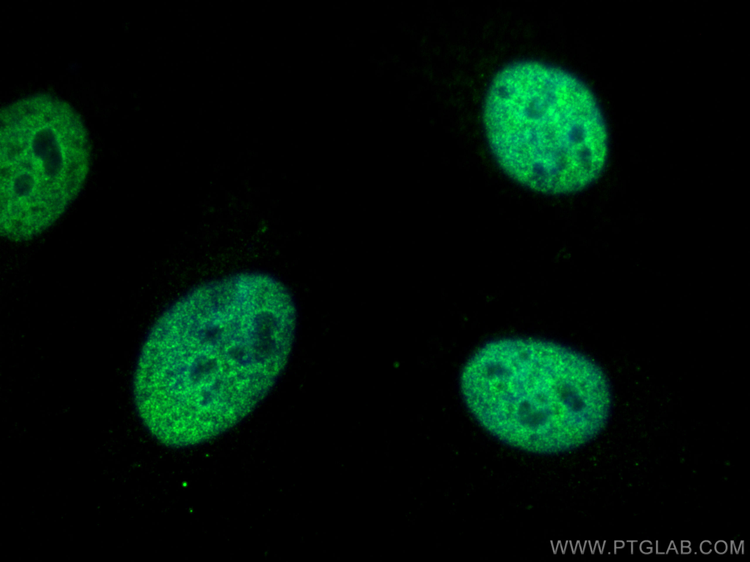 Immunofluorescence (IF) / fluorescent staining of HeLa cells using ADNP Polyclonal antibody (17987-1-AP)