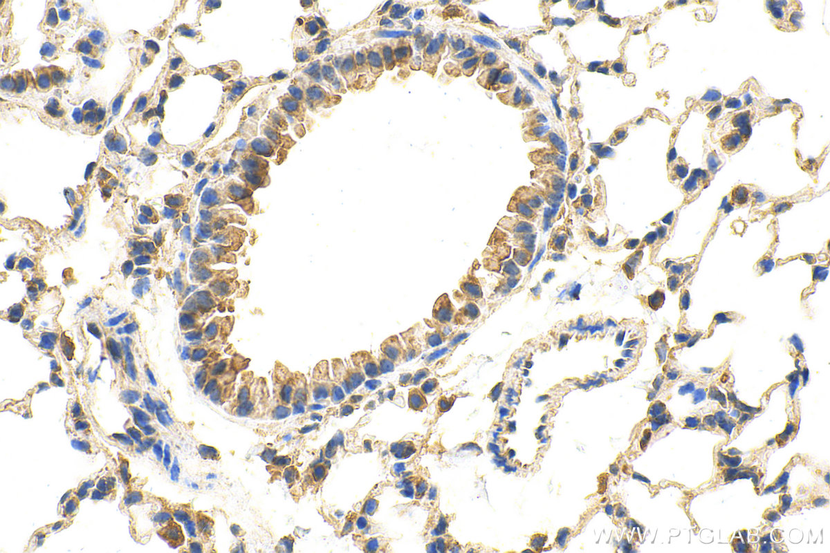 Immunohistochemistry (IHC) staining of mouse lung tissue using ADRB1 Polyclonal antibody (28323-1-AP)