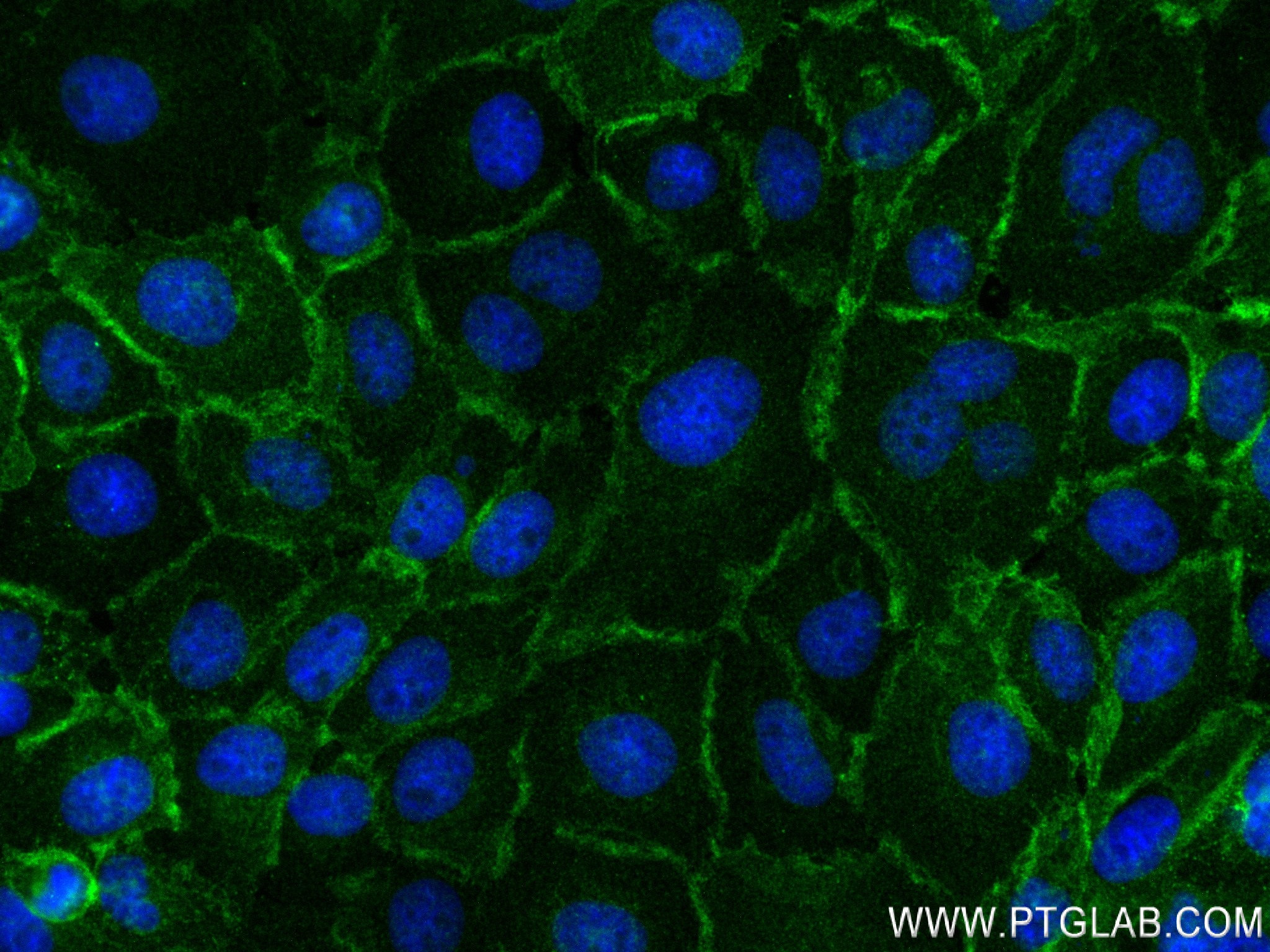 Immunofluorescence (IF) / fluorescent staining of A431 cells using ADRB2 Recombinant antibody (83317-5-RR)