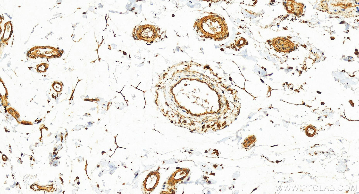 Immunohistochemistry (IHC) staining of human colon tissue using GRK3 Polyclonal antibody (13727-1-AP)