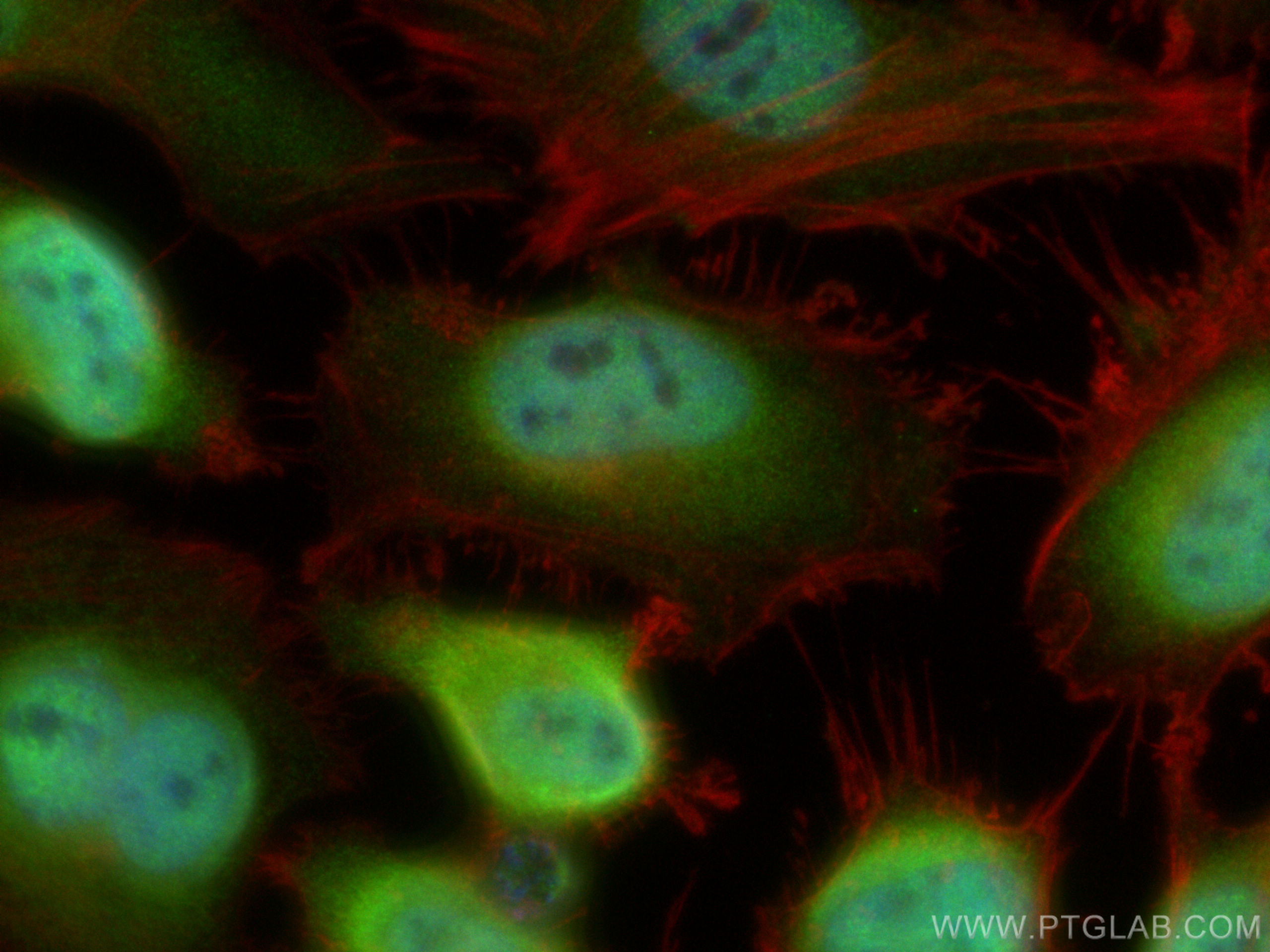 Immunofluorescence (IF) / fluorescent staining of HeLa cells using ADRM1 Polyclonal antibody (11468-1-AP)