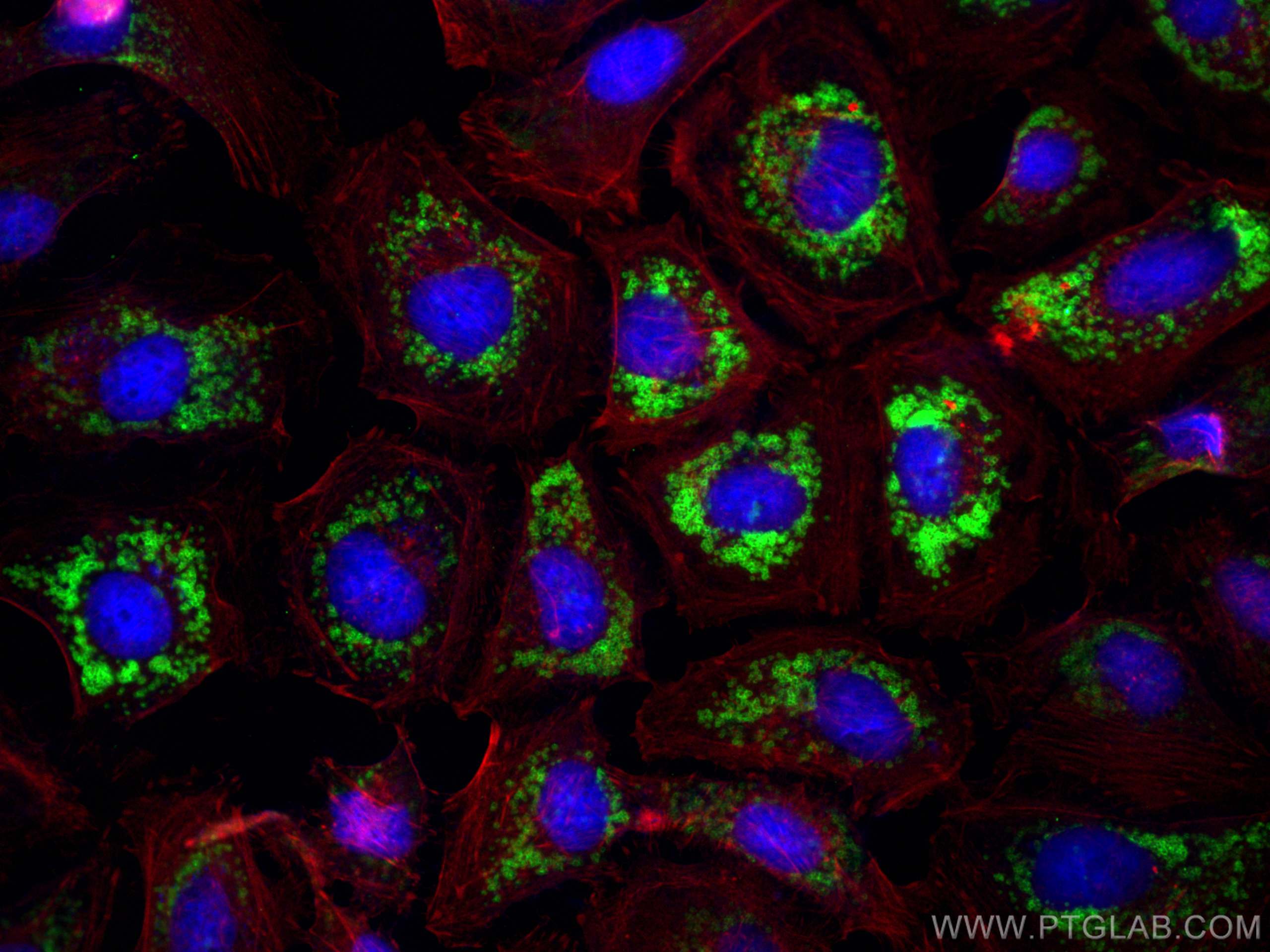 Immunofluorescence (IF) / fluorescent staining of HeLa cells using ADRP/Perilipin-2 Polyclonal antibody (15294-1-AP)