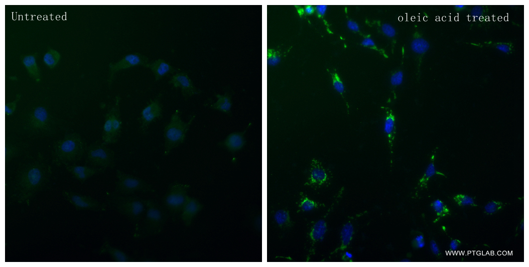 Immunofluorescence (IF) / fluorescent staining of HeLa cells using ADRP Recombinant antibody (80362-2-RR)