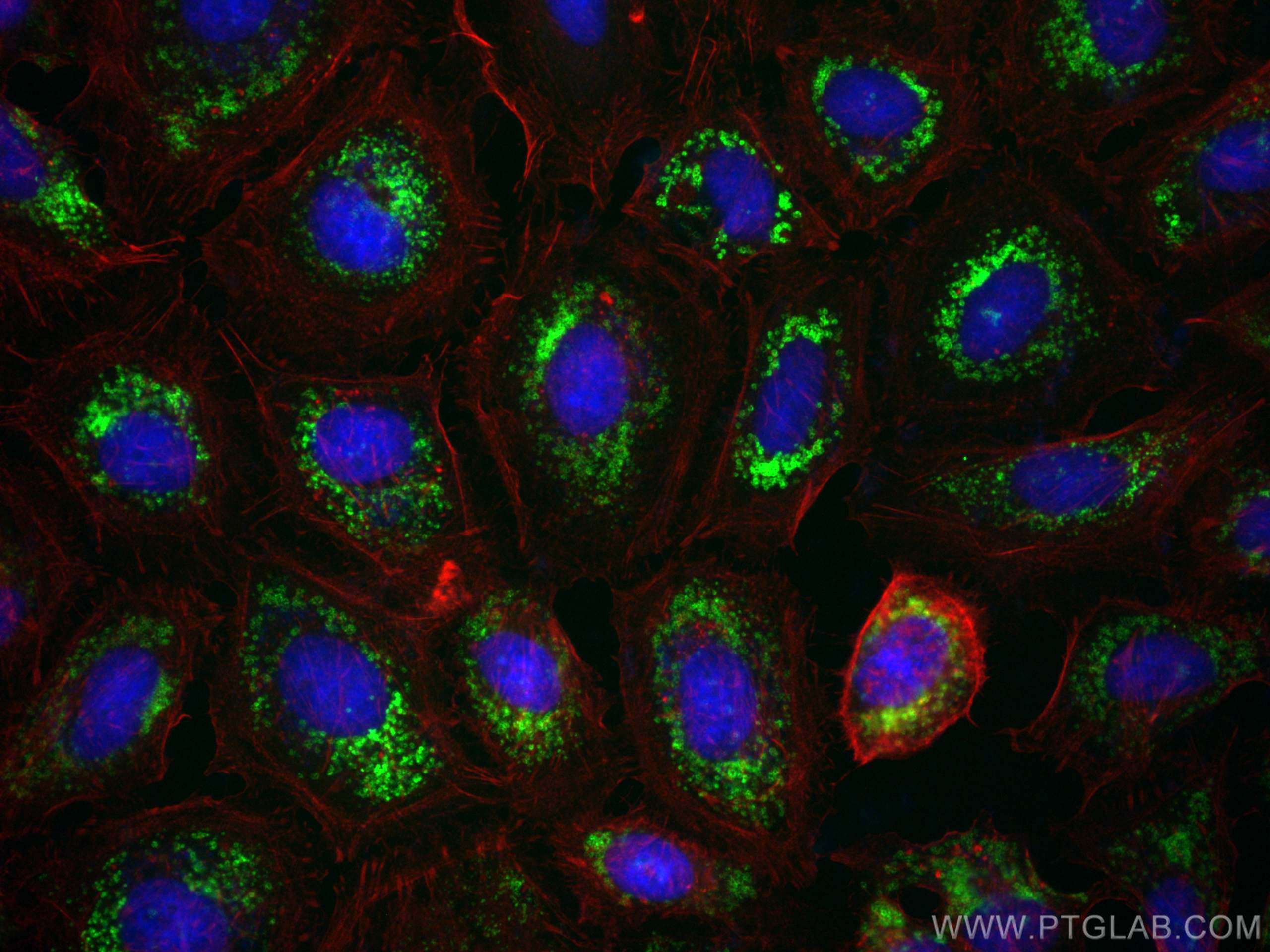 Immunofluorescence (IF) / fluorescent staining of HeLa cells using Perilipin-2 Recombinant antibody (80362-2-RR)