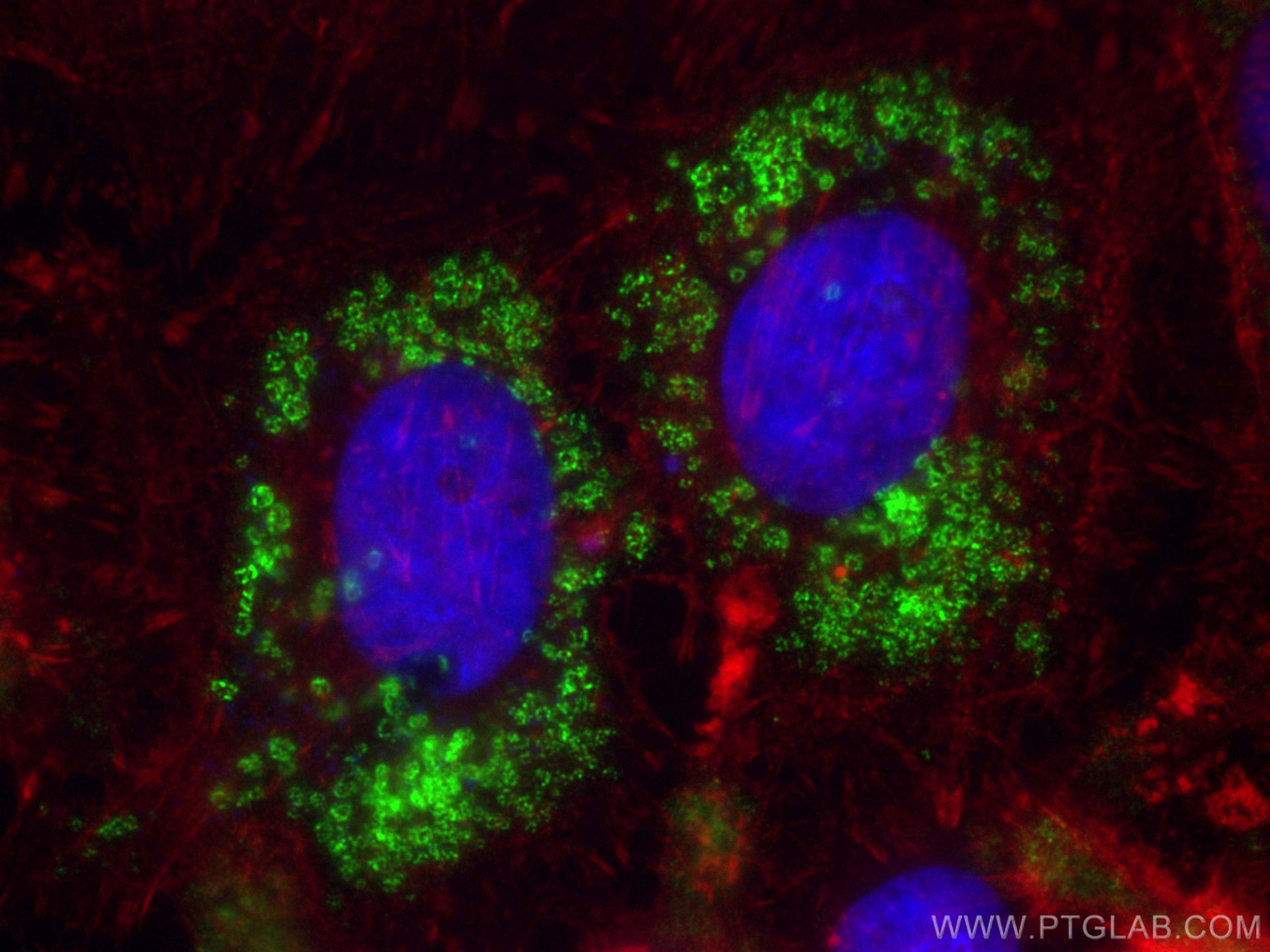 Immunofluorescence (IF) / fluorescent staining of HeLa cells using Perilipin-2 Recombinant antibody (80362-2-RR)