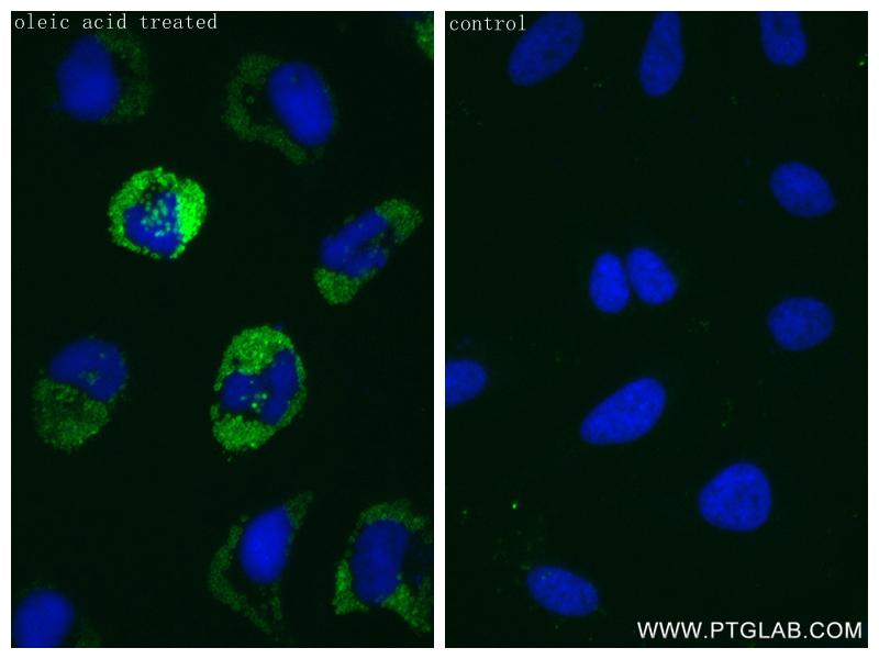 Immunofluorescence (IF) / fluorescent staining of HeLa cells using Perilipin-2 Recombinant antibody (80362-2-RR)