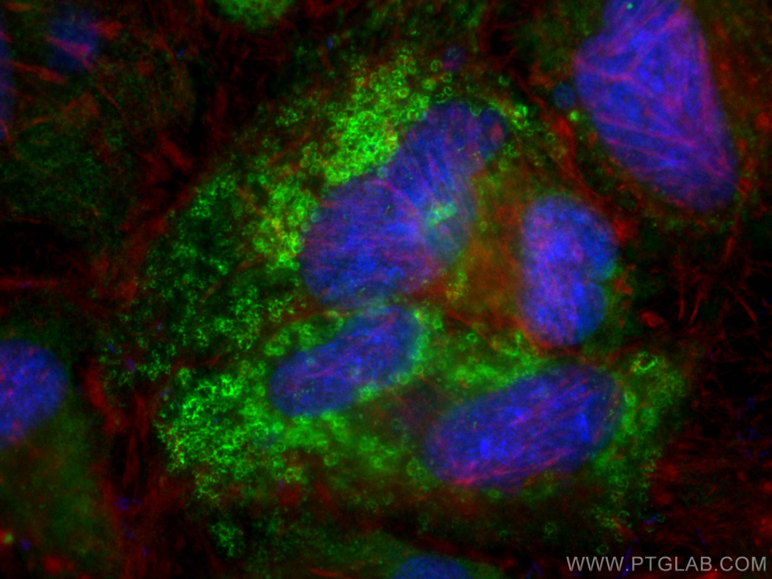 Immunofluorescence (IF) / fluorescent staining of HeLa cells using CoraLite® Plus 488-conjugated ADRP Recombinant ant (CL488-80362-2)