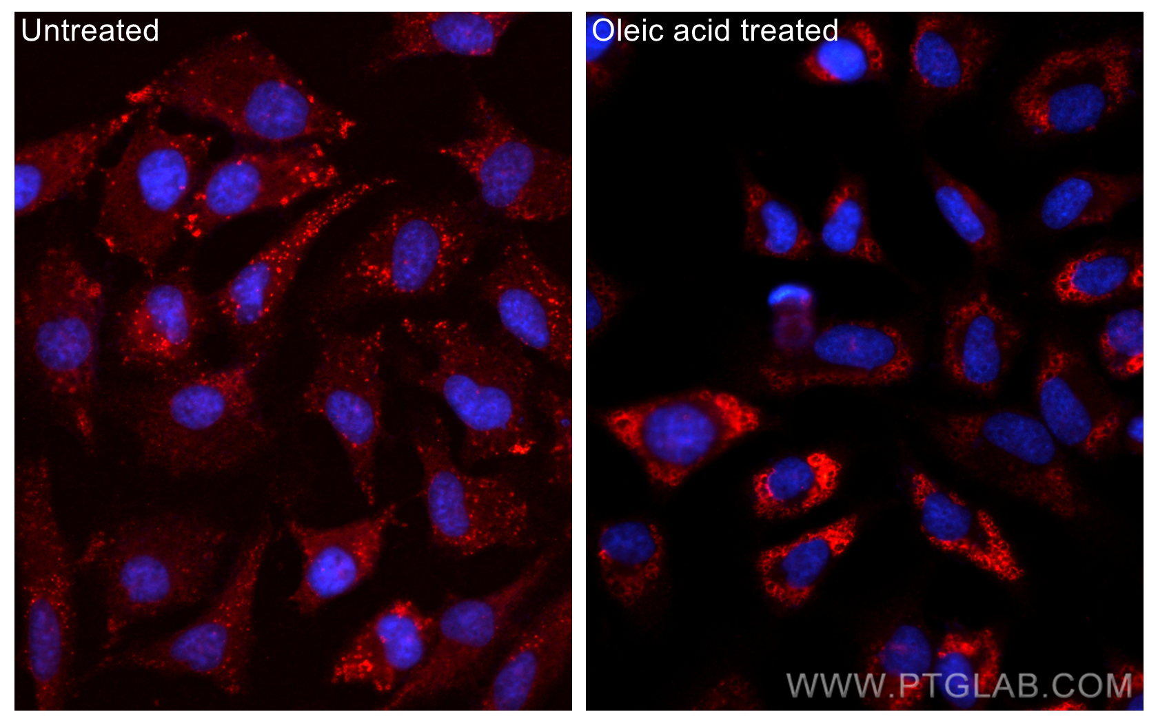 Immunofluorescence (IF) / fluorescent staining of HeLa cells using CoraLite®594-conjugated Perilipin-2 Polyclonal ant (CL594-15294)