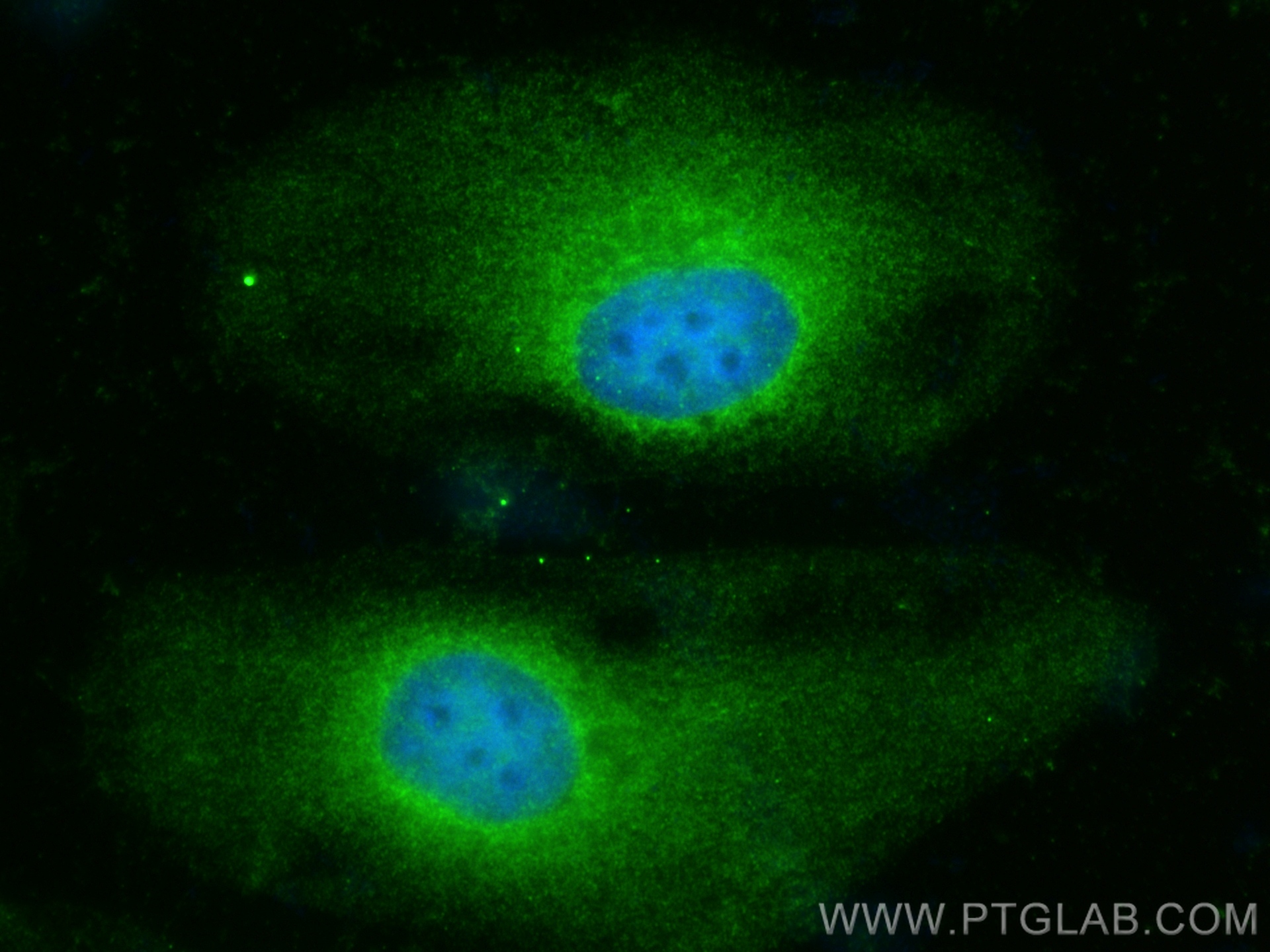 Immunofluorescence (IF) / fluorescent staining of HeLa cells using Adenylosuccinate lyase Polyclonal antibody (15264-1-AP)