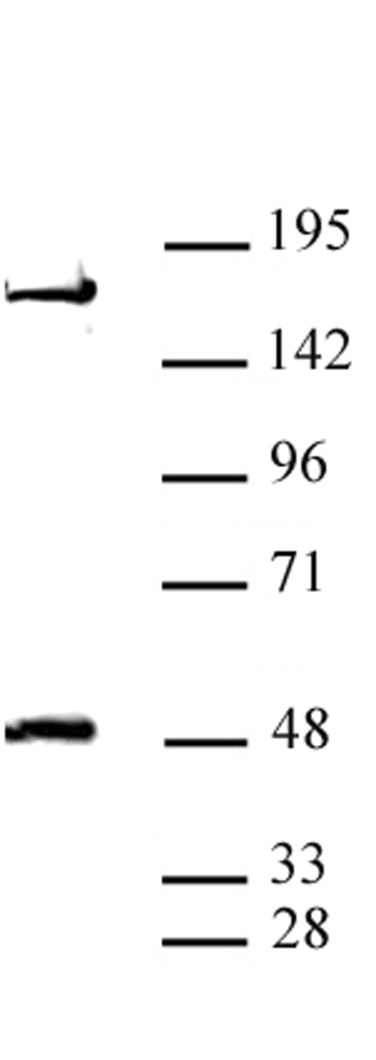 AEBP2 antibody (pAb) tested by Western blot. AEBP2 detection by Western blot. The analysis was performed using 20 ug P19 nuclear cell extract and AEBP2 antibody at a 1:2,500 dilution. An unspecified band is detected around 160 kDa.