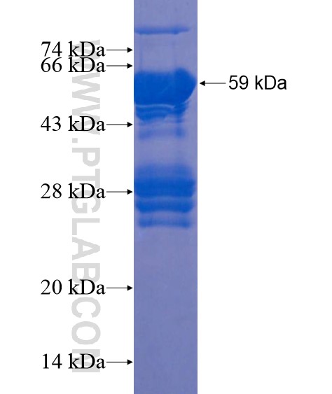 AFF2 fusion protein Ag22225 SDS-PAGE