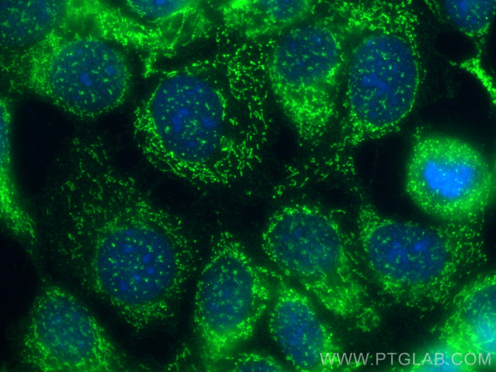 Immunofluorescence (IF) / fluorescent staining of MCF-7 cells using AFG3L2 Monoclonal antibody (68517-1-Ig)