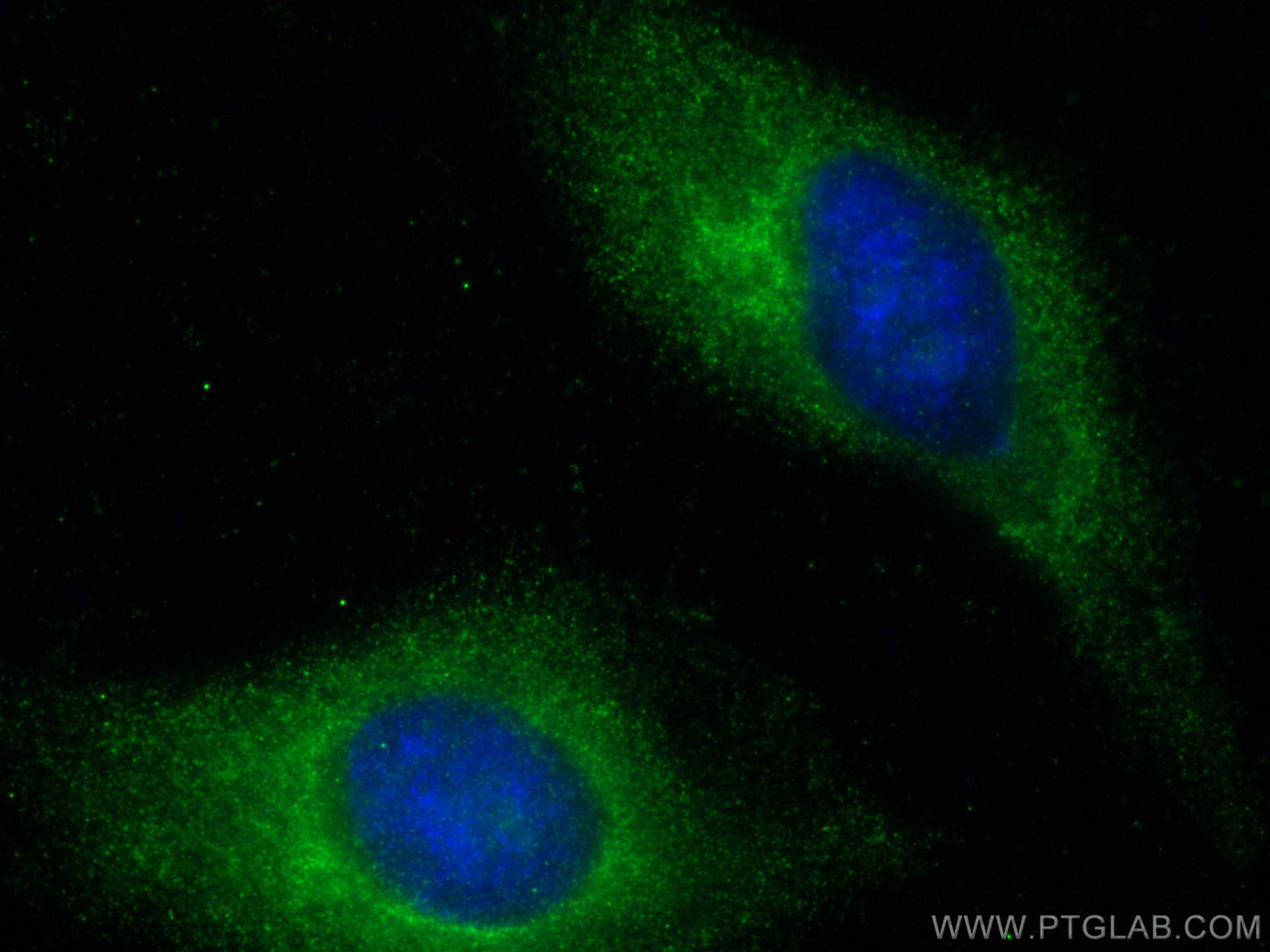 Immunofluorescence (IF) / fluorescent staining of HeLa cells using AFM Polyclonal antibody (19494-1-AP)